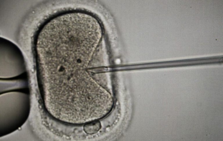 Infertilidad: disminuye cantidad y calidad de los espermatozoides