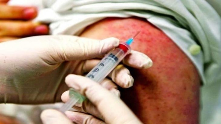 Un nuevo caso de  sarampión en Rosario. Alerta epidemiológico