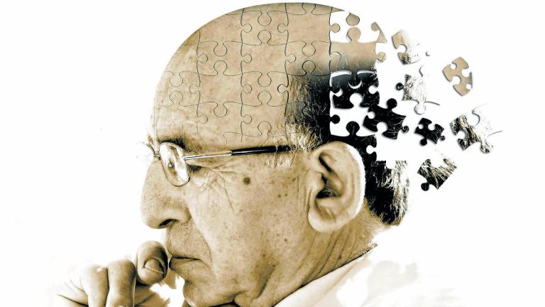 Esperanza para el Alzheimer: resultados alentadores de un ensayo con lecanemab