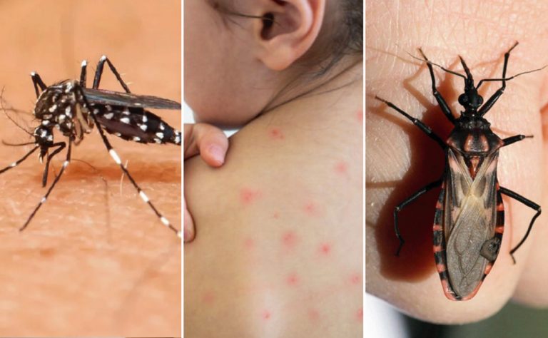Dengue, chagas y sarampión: las otras epidemias