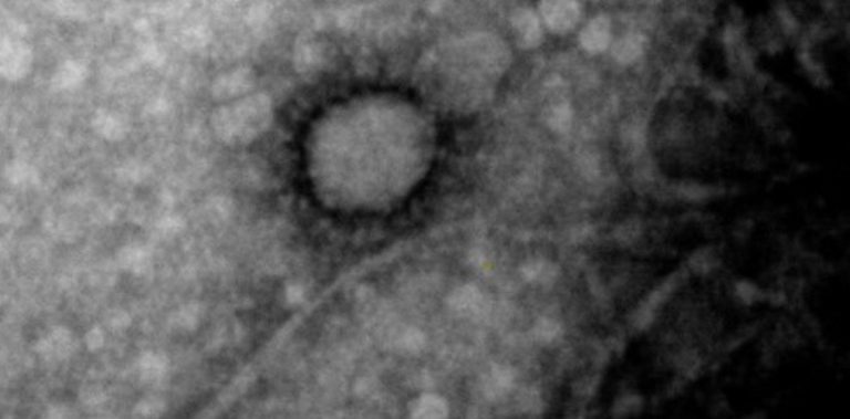 El Malbrán obtuvo la primera imagen de la cepa del coronavirus que circula en la Argentina