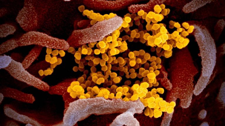 Cinco genes presentes en los casos severos de coronavirus
