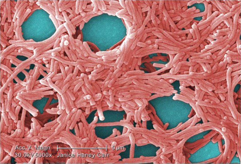 Legionella: encontraron la bacteria culpable del brote infeccioso en Tucumán