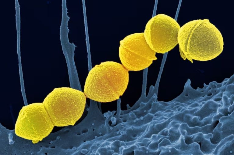 Crece las infecciones en nuestro pais por la bacteria Streptococcus pyogenes. 64 muertes en 2023