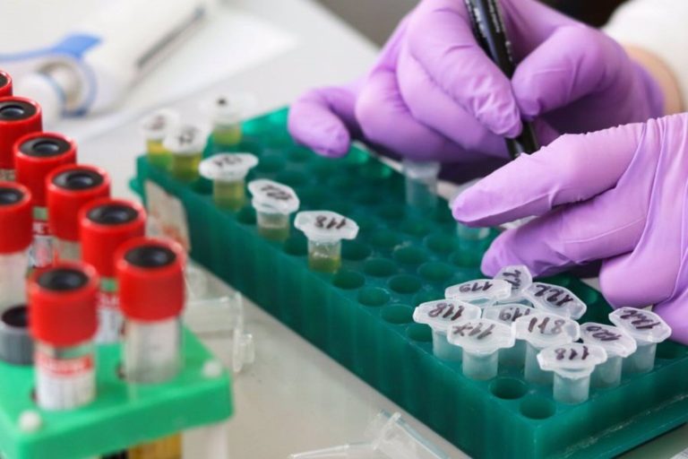El gobierno libera las importaciones de insumos para investigación científica