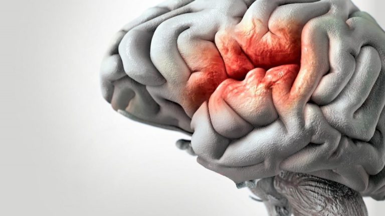 Una molécula para mejorar el diagnóstico de Parkinson y Alzheimer