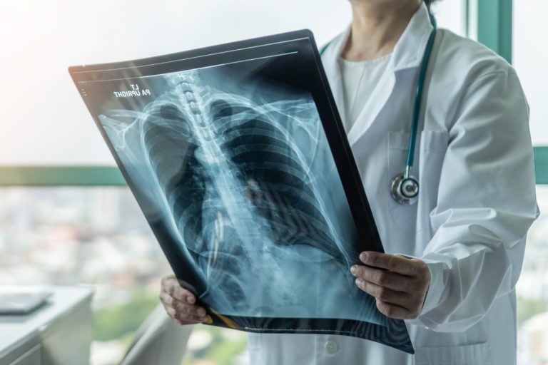Radiografía del cáncer en el mundo: el que más aumenta en adultos jóvenes y otros índices