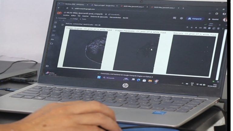 Acercando un primer diagnóstico: Inteligencia artificial para detectar cáncer de mama