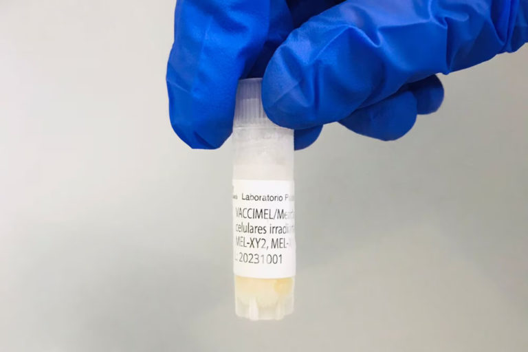 Cáncer de piel: está disponible una vacuna argentina para tratar el melanoma de alto riesgo