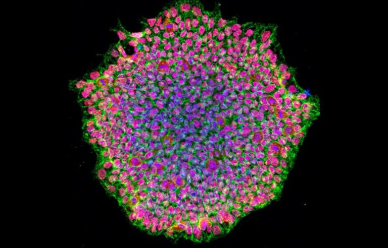 Japón avanza hacia la aprobación de tratamientos con células madre