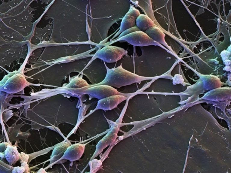CIENCIA BREVE: La actividad genética cerebral difiere entre sexos.