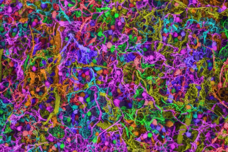 CIENCIA: El cerebro humano construye oraciones, neurona por neurona