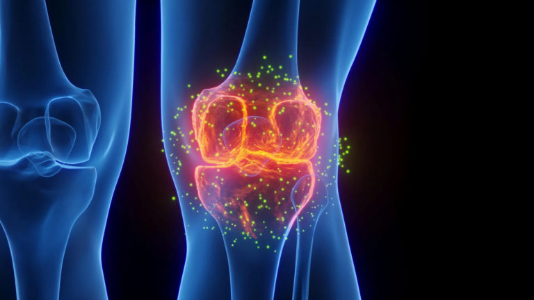 Logran regenerar cartílago y revertir artritis en estudios preclínicos