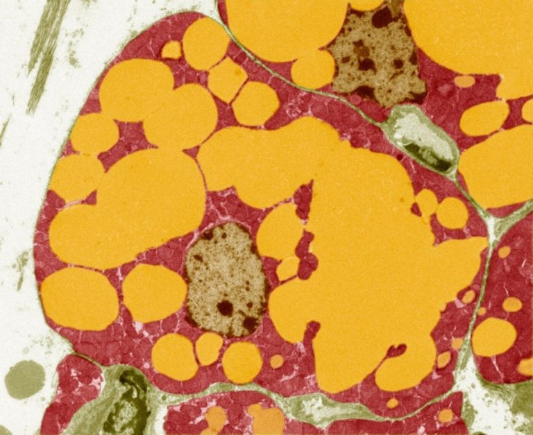 Nature: Mutaciones en un gen humano vinculadas a beneficios de amplio alcance