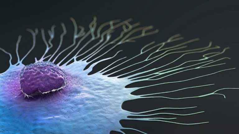 Un modelo de IA predice qué medicamentos para el cáncer de mama son los más efectivos