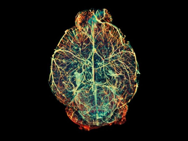 El desarrollo del cerebro: nuevos experimentos desafían la imagen existente