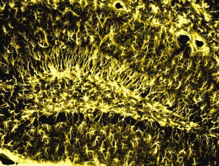 La memoria se mantiene en la vejez cuando esta enzima cerebral está activa